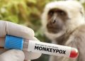 Parlemen RI-Afrika Desak Langkah Konkret Pemerintah Cegah Wabah Mpox